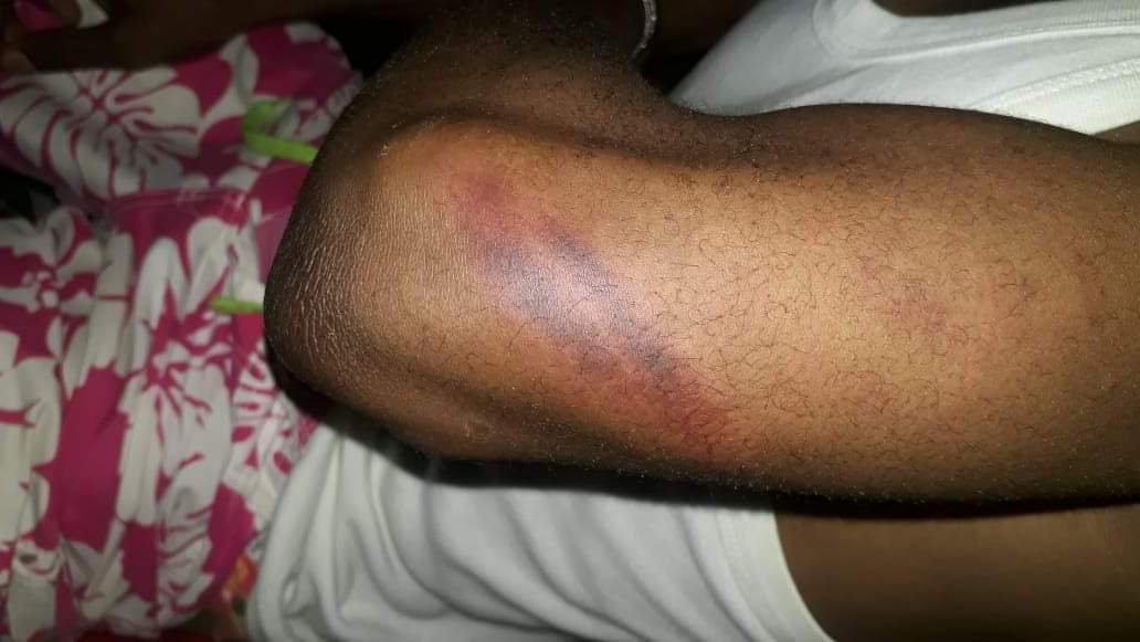 Torture des détenus dans les prisons. Devant la multiplication des cas les Ongs saisissent l’Onu