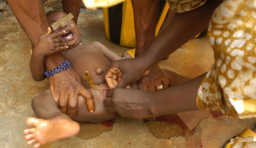 Alerte dans l’ Extrême-Nord et dans le Sud-Ouest . 20% de jeunes filles victimes de mutilations génitales féminines